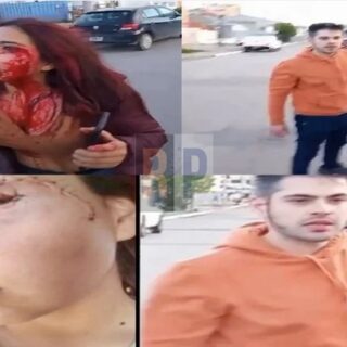 Comienza juicio a un hombre acusado de “lesiones graves” contra una mujer a la salida de un pub