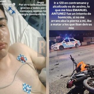 “Ir a 120 a contramano y alcoholizado es de asesino”, posteó el joven motociclista que perdió una pierna tras violento accidente