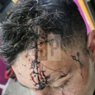 Hombre denunció brutal agresión en Ushuaia e investigan si es un caso de “viudas negras”