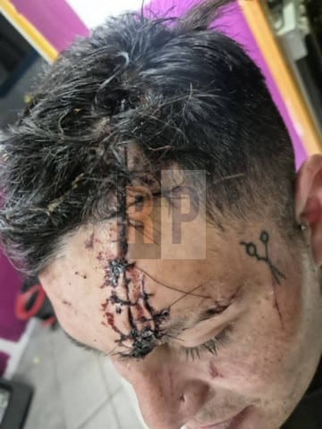 Hombre denunció brutal agresión en Ushuaia e investigan si es un caso de “viudas negras”